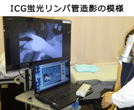 Scene of ICG fluorescence lymphangiography (lower figure)
