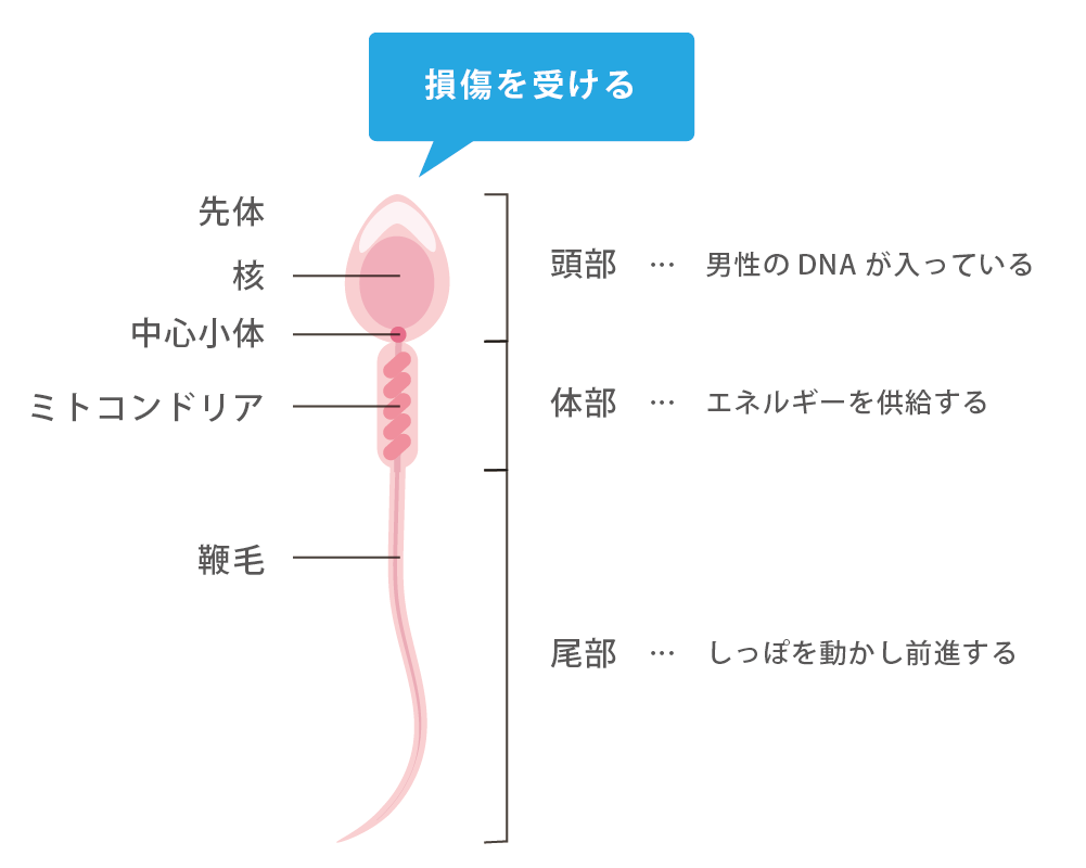 精子の損傷