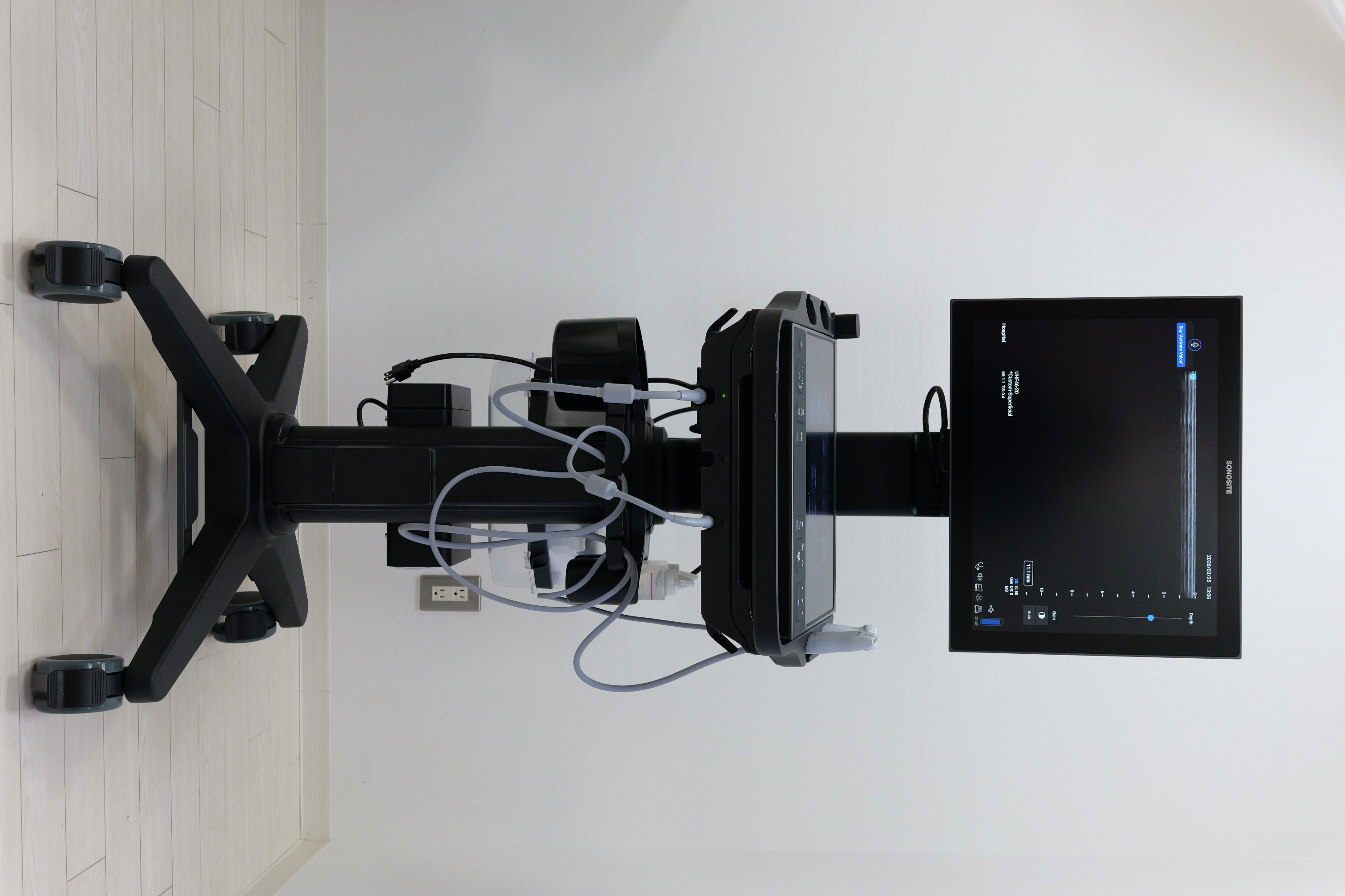 超高周波超音波画像診断装置 Sonosite LX